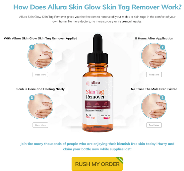 Allura Skin Glow Skin Tag Remover
